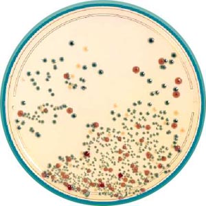 大肠杆菌菌落及菌体图片